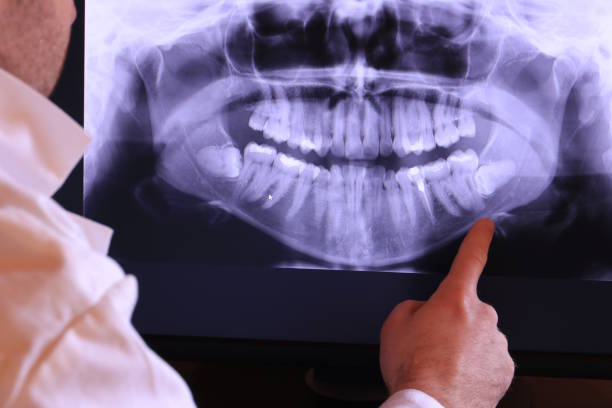Best Broken or Chipped Tooth Repair in Cloverleaf, TX